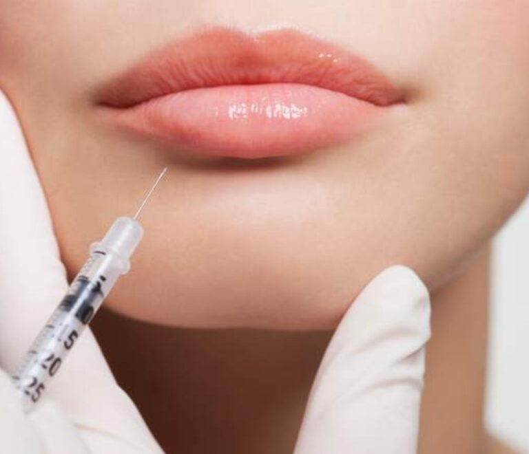 Dermal Fillers