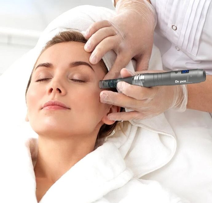 What Is Microneedling?